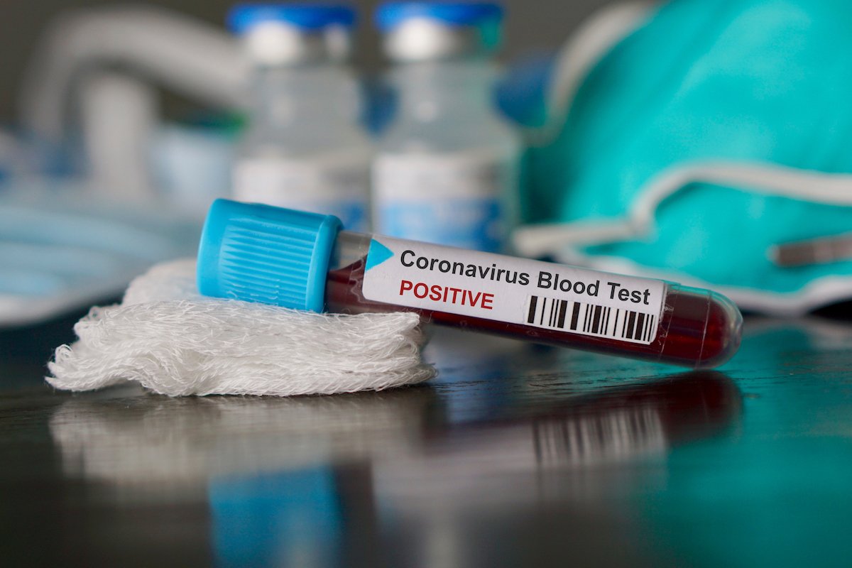 En Ontario se confirma la primera muerte de un infectado por el coronavirus 