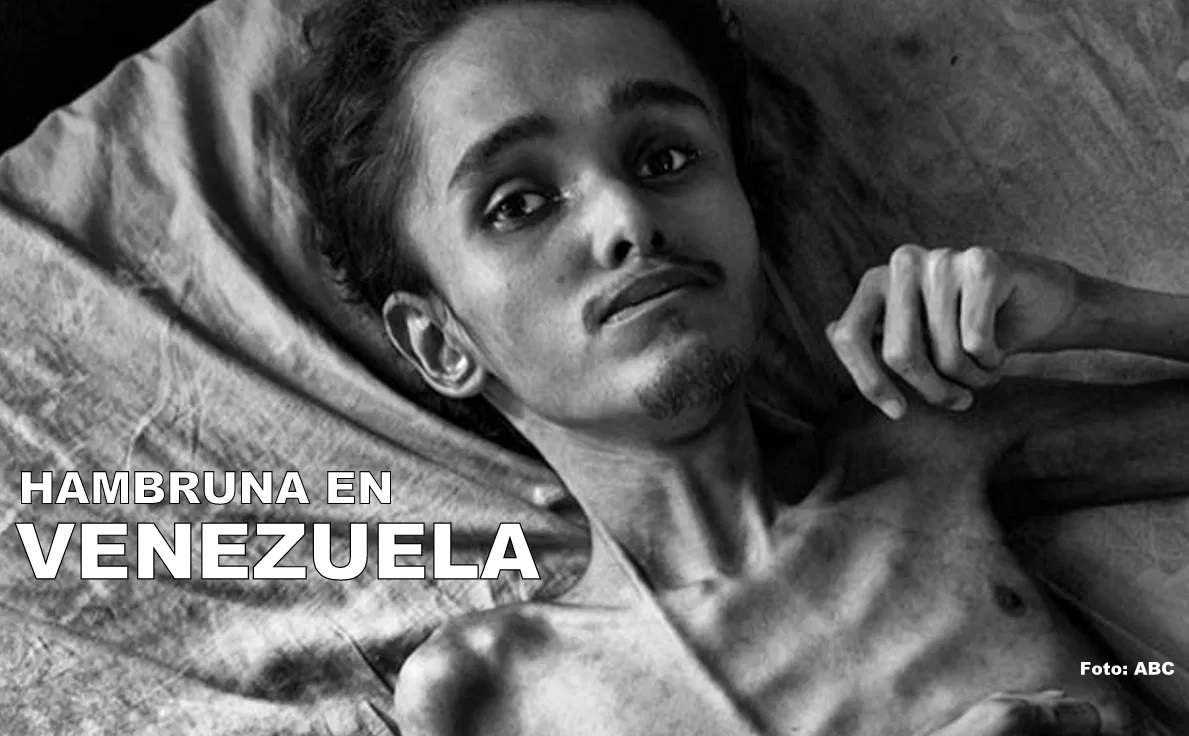 La hambruna se expande más rápido que la misma pandemia en Venezuela