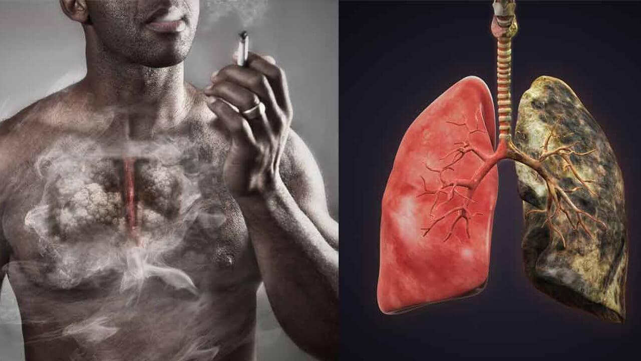 Si deja de fumar las células sanas logran recuperarse y reparar sus pulmones   