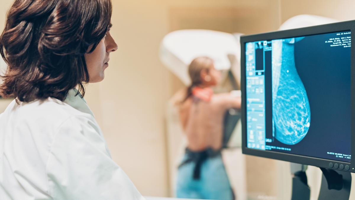 ¿Cada cuánto debe realizarse una mamografía para detectar un cáncer?