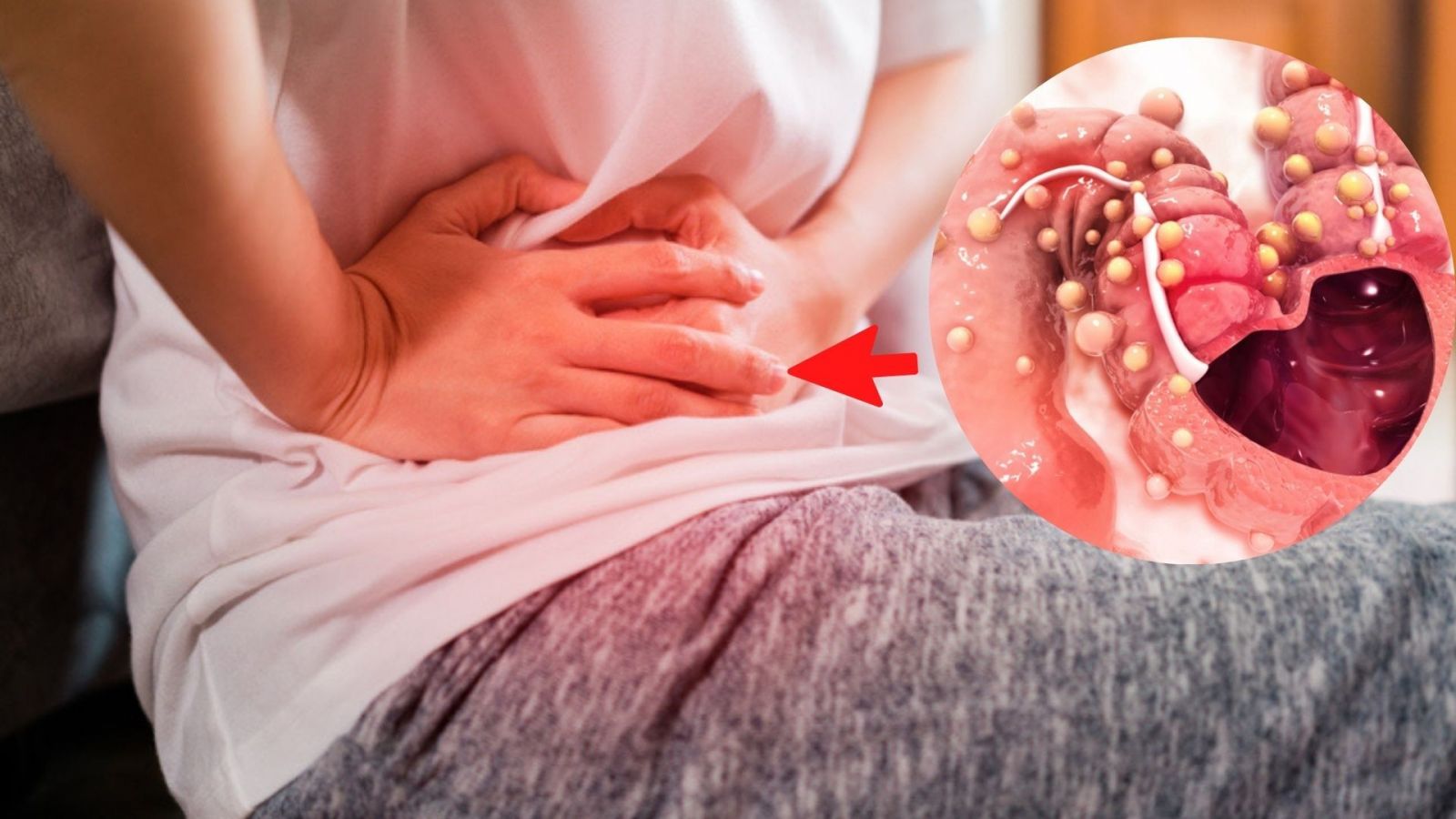 Lo que debe saber para enfrentar el cáncer de colon 
